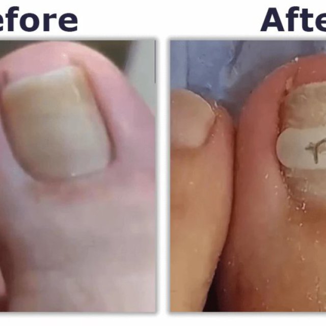 Harley Medical Foot and Nail Laser Clinic